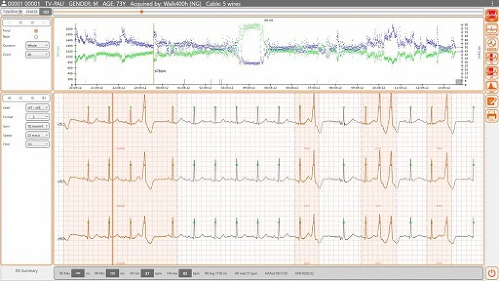 Walk400h 3/12ch Cardioline ecg Holter